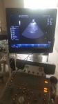 GE original imaging ultrasound machine Logiq P6