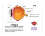Human Eyeball Cataract Anatomy Medical Science Human Eye Anatomy Model