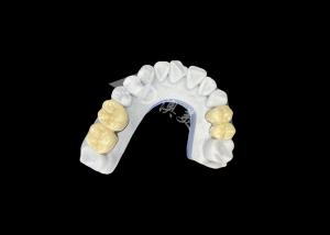 Wholesale Zirconia PFZ Porcelain Dental Crown From Professional China Dental Lab from china suppliers