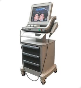 Wholesale 2016 most effective hifu high intensity focused ultrasound face lift wrinkle removal from china suppliers