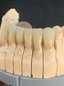 Wholesale OEM Translucent Dental Zirconia Blank 3D Pro Dental Zirconia Block from china suppliers