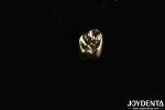 Metallic Material Dental Gold Crown , Gold Tooth Crown For Optimal Oral