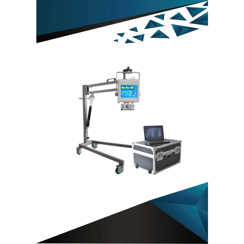 STXR-Y100 Digital Portable X Ray Machine High Frequency For Clear And Detailed Imaging