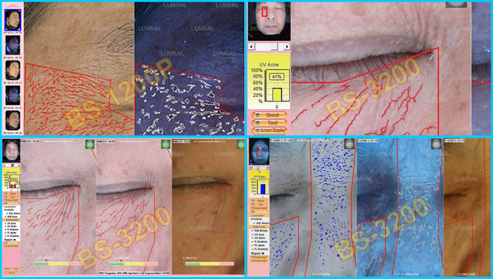 Auto - Analysis Skin Analysis Machine Lightweight With UV Voice System