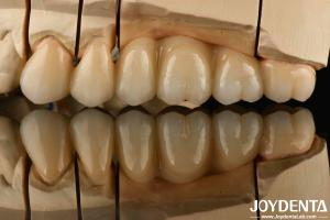 Wholesale White Full Zirconia With High Resistance To Thermal Shock High Strength from china suppliers