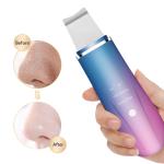 Ultrasonic Ion Therapy Vibrating Facial Scrubber Skin Clean Peeling Warm Scraper
