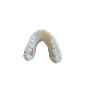 Wholesale Digital Oral Scanning PFM Dental Crowns Bridge Implantology Demands from china suppliers