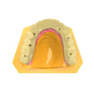 Dental Bridge Photosensitive Resin