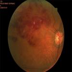 Autofocus Ultra Wide Field Fundus Camera 3.3mm Non Contact