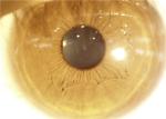 Handheld Slit Lamp Portable Ophthalmoscope Camera