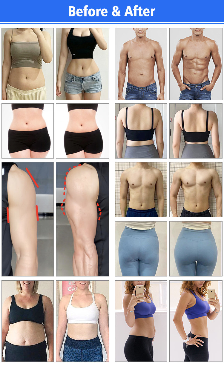 Painless Body Fat Reduction Machine , Brazilian Butt Lift Machine