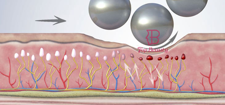 7d Roller Therapy Anti Cellulite Roller Body Contouring Machine