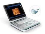 Medical Ultrasound Machine Portable Ultrasound Scanner 4d Ultrasound Equipment