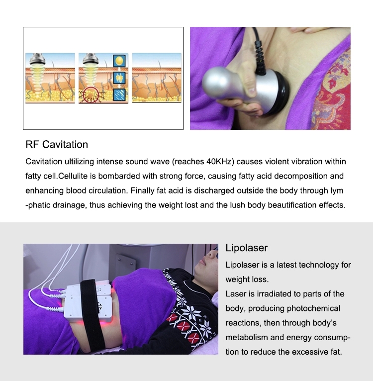 DM-55 Portable RF Cryolipolysis Slimming Machine 350mW pulse Fat Freezing