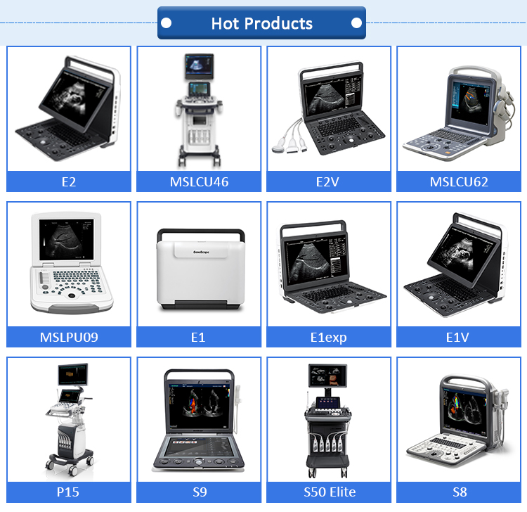 Best Cheap Price Medical Ultrasound Diagnostic System Laptop Portable Color Doppler Ultrasound Machine for Hospital