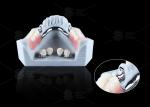 Titanium Dental Implant Ball Attachments Comfortable Secure Denture Retention