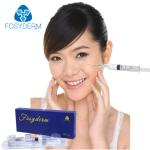Cross Linked Hyaluronic Acid Gel Filler Lidocaine For Removing Facial Wrinkle
