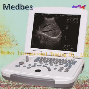 Wholesale Labtop Vet Ultrasound Scanner Machine from china suppliers