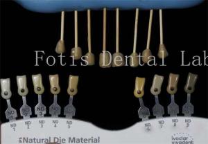 Wholesale Durable 0.3-0.5mm Thick Dental Lab Veneers Fake Veneers For Teeth from china suppliers