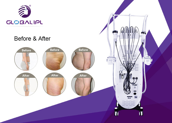 RF Fat Dissolving Cryolipolysis Machine 8.4 Inch Touch Screen Display CE Assured