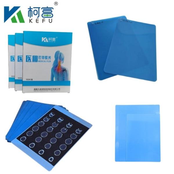 Wholesale International Medical Inkjet Film Blue X-ray Film Thermal Films For