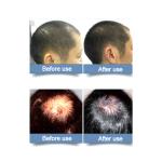 5V2A USB LLLT Laser Hair Regrowth Hat Hair Growth Helmet Baseball Cap That Grows