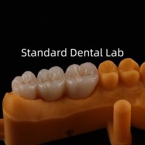 Wholesale Be Ni Free Metal Porcelain Crowns Precise Esthetic PFM Crown Dental from china suppliers