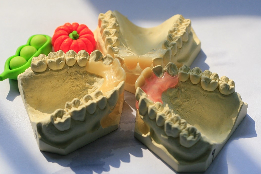 Soft Elastic Nylon Trushine Invisible Denture