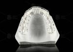 Hard Occlusal Splint Dental For Jaw Pain Relief Protection Oral Splint