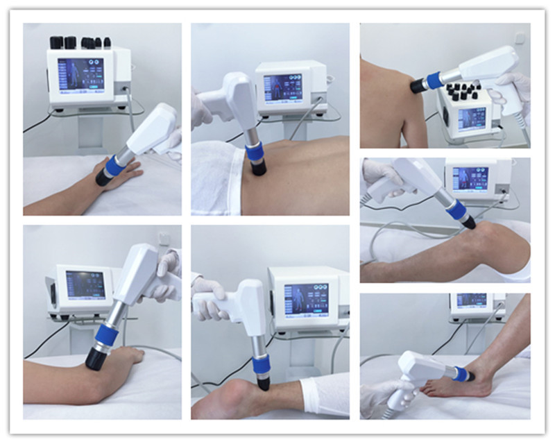 Extracorporeal Air Pressure Therapy Machine Acoustic Wave Type For Sports Injury Recovery