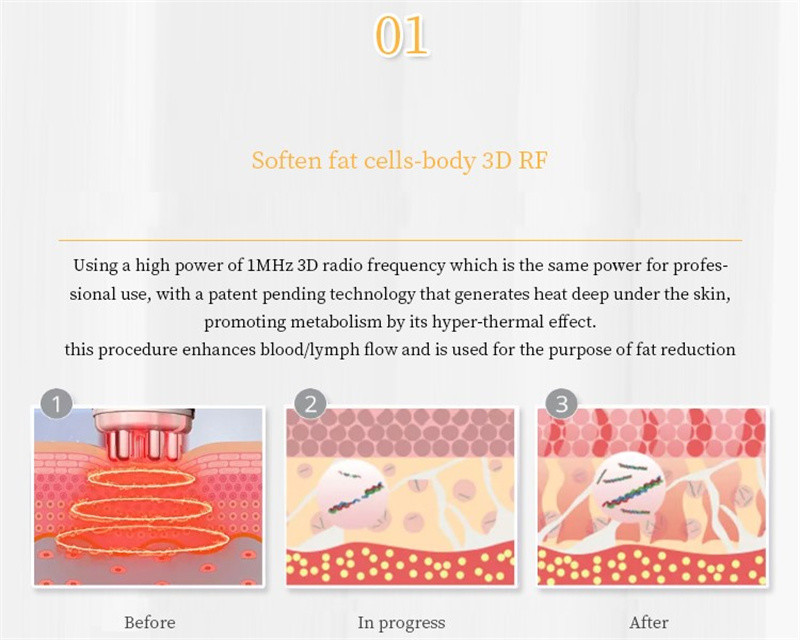 6 In 1 Radio Frequency 40k Ultrasonic Cavitation Machine Skin Tightening Fat Loss