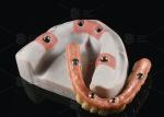 Hybrid Pink Porcelain Implant Crown Malong Full Arch Implant Bridge Immediate
