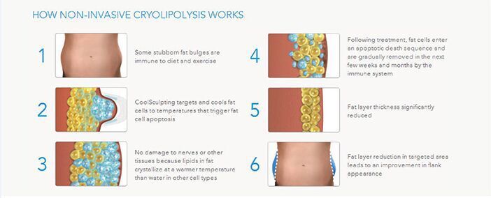 2015 Newest Beauty Equipment Cryolipolysis Fat Reducing fat freeze slimming cryolipolysis slimming machine