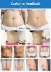 Non Invasive Laser Lipo Machine , Cold Laser Therapy Machine For Body Slimming /