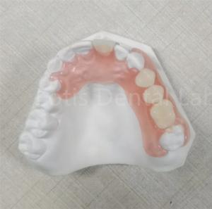 Wholesale Pink / Transparent TCS Valplast Odor Resistant Flexible Dental Prosthesis from china suppliers