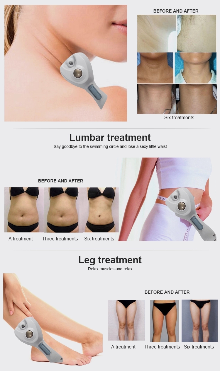 DS-35 Ultrasonic Radio Frequency Machines 300W Body Slimming Body Shaping