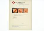 8 x 10inch Medical Paper Laser X Ray Diagnostic Imaging For KND-DRYTEC 4000