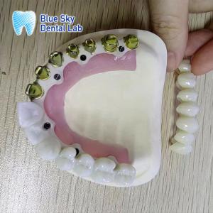 Wholesale Silver Gold Pure Titanium Metal Frame Dental Gold Plated Metal Frame Partial from china suppliers