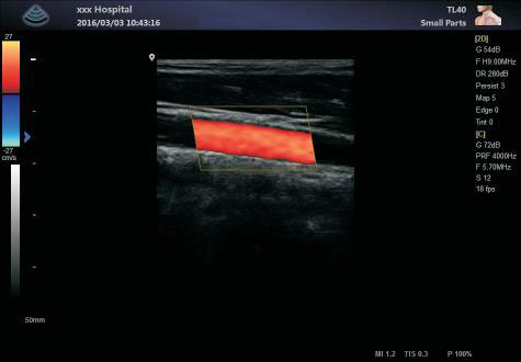 Portable Full Digital Color Doppler Ultrasound System Medical Scanner Ultrasound
