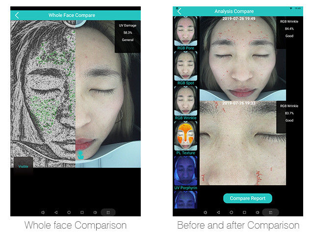Multifunction Skin Hydration Analyzer With 30 Million Clinical Databases