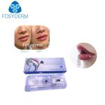 1ml hyaluronic acid lip fillers Derm Lip Enhancement Injection For Women