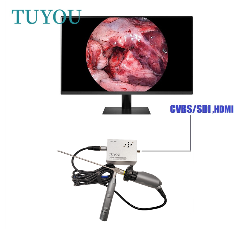 TUYOU White Flexible Endoscope Camera With HD Resolution For Medical laparoscopy machine