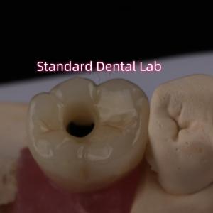 Wholesale Posterior Implant Crown Bruxier Solid Zirconia Screw Retained from china suppliers