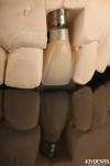 Zirconia Custom Abutments And Bars Dental Restorations For Individual Patient's
