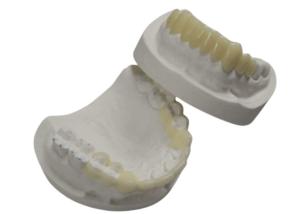 Wholesale High Durability CAD CAM 3D Printing Temporary Crowns Durable Resin from china suppliers