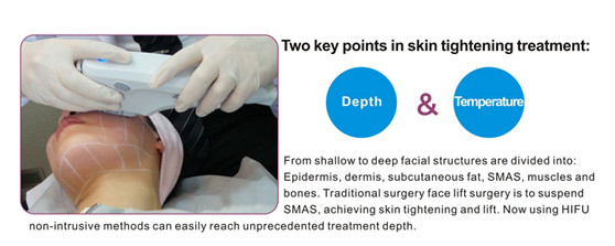 Painless Safe HIFU Machine Long Lasting Used In Acne Removal