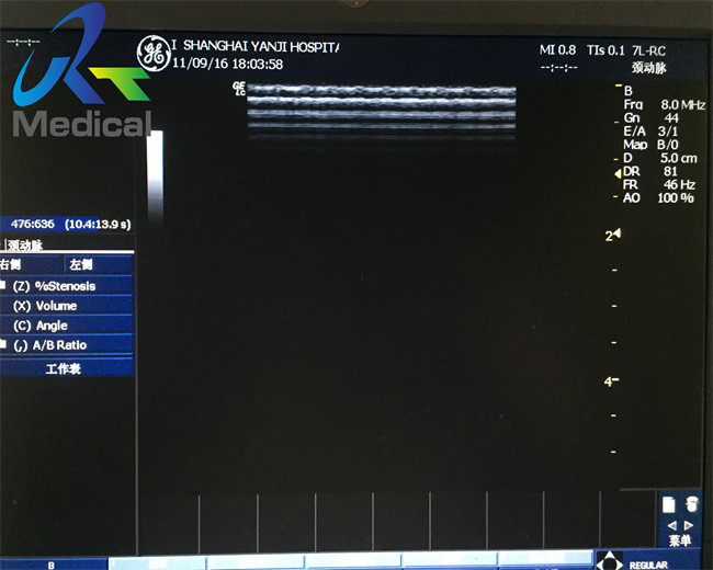 GE 7L-RC 12MHz Wide Band Linearx Used Ultrasound Probe Medical Hospital Instrument