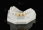 Durable Hypoallergenic EMAX Bridge Extreme Esthetics Emax Dental Bridge