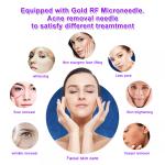Skin Tightening RF Microneedling Machine