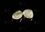 Sleek Full Cast Metal Crown Precious Alloy Gold 20% Polished Full Metal Dental